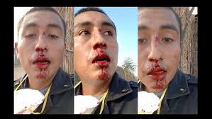 Piura: Turba ataca a palazos a comisario cuando hacía cumplir el estado de emergencia