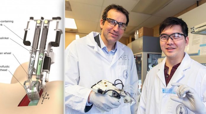 Científicos canadienses crean dispositivo que imprime nueva piel sobre quemaduras