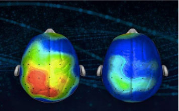 Los neurocientíficos descubren una canción que reduce la ansiedad en un 65 por ciento (Escuche)