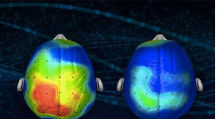 Los neurocientíficos descubren una canción que reduce la ansiedad en un 65 por ciento (Escuche)