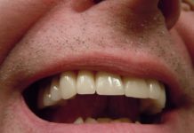¿Por qué duelen los dientes, muelas y encías?