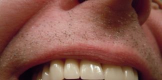 ¿Por qué duelen los dientes, muelas y encías?