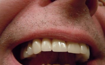 ¿Por qué duelen los dientes, muelas y encías?