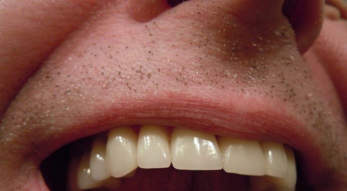 ¿Por qué duelen los dientes, muelas y encías?